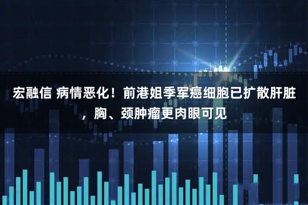 宏融信 病情恶化！前港姐季军癌细胞已扩散肝脏，胸、颈肿瘤更肉眼可见